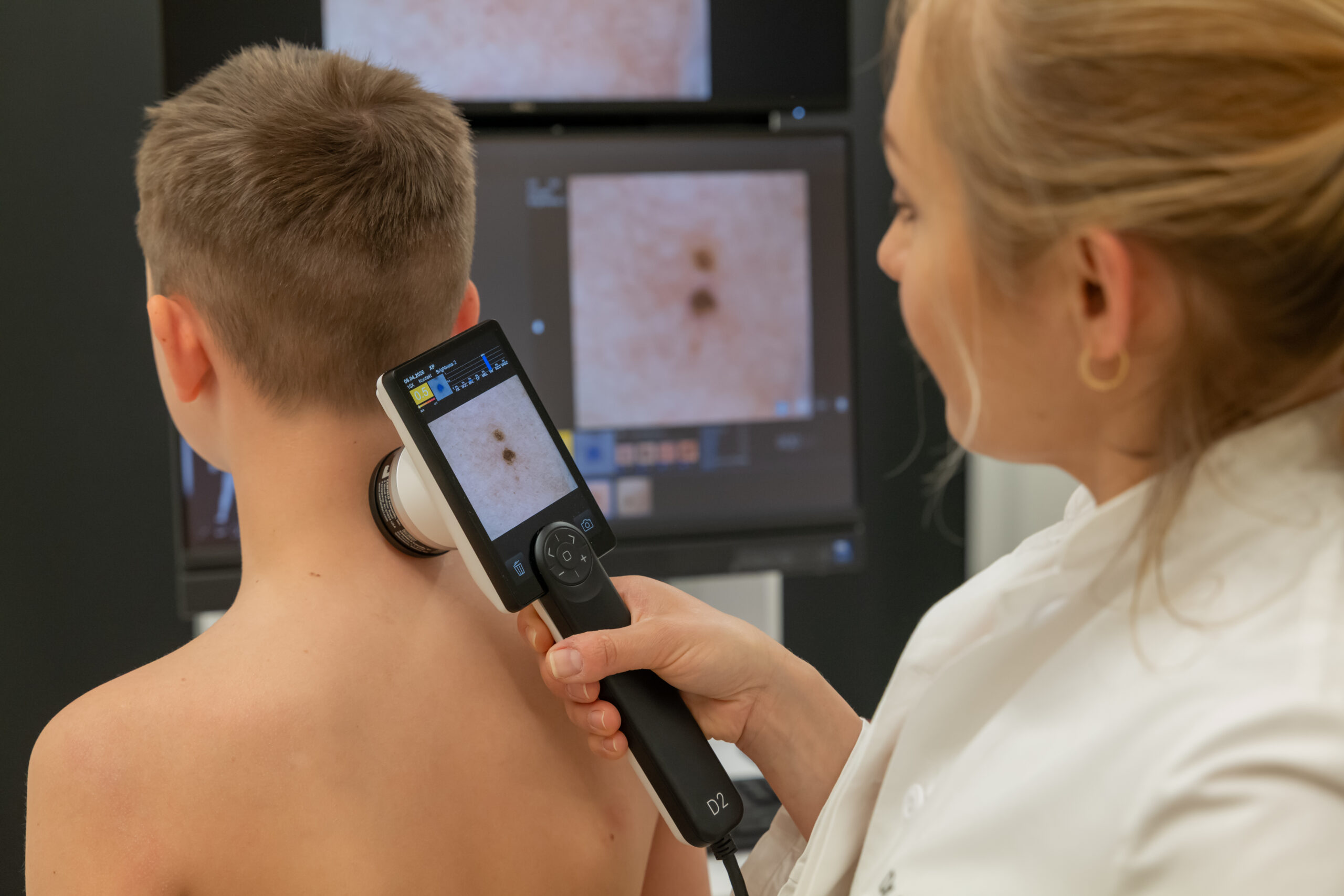 Dr. med Alena Höfemann untersucht Muttermale.